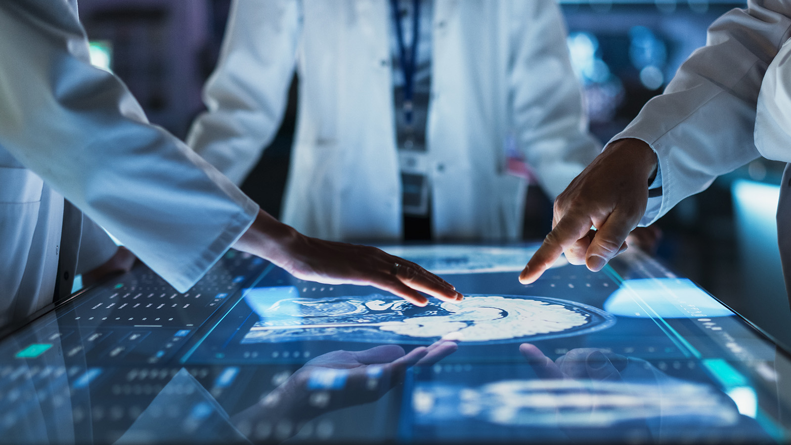 La maladie d'Alzheimer peut être retardée !  Une nouvelle variante génétique a été découverte