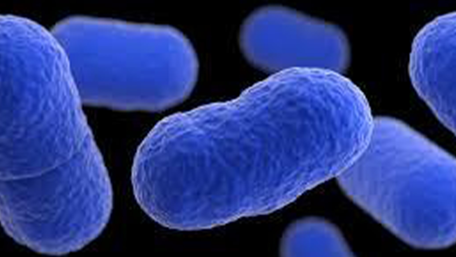 La bactérie Listeria a été détectée !  Des milliers de kilos de produits de charcuterie sont rappelés