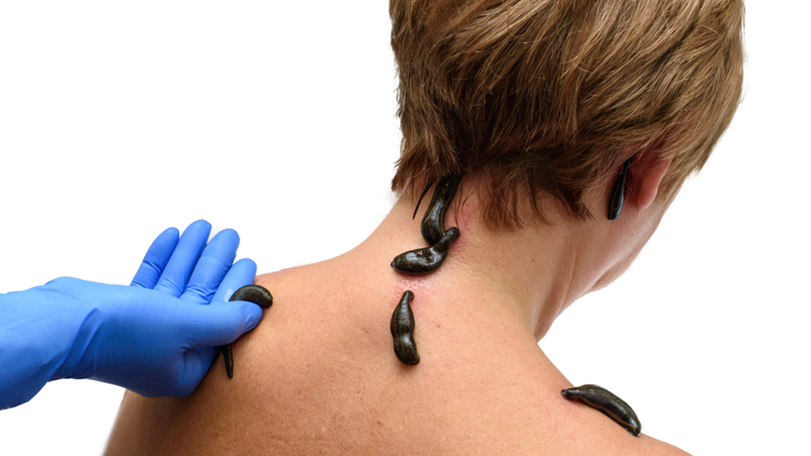 Les médecines alternatives sont-elles dangereuses ?