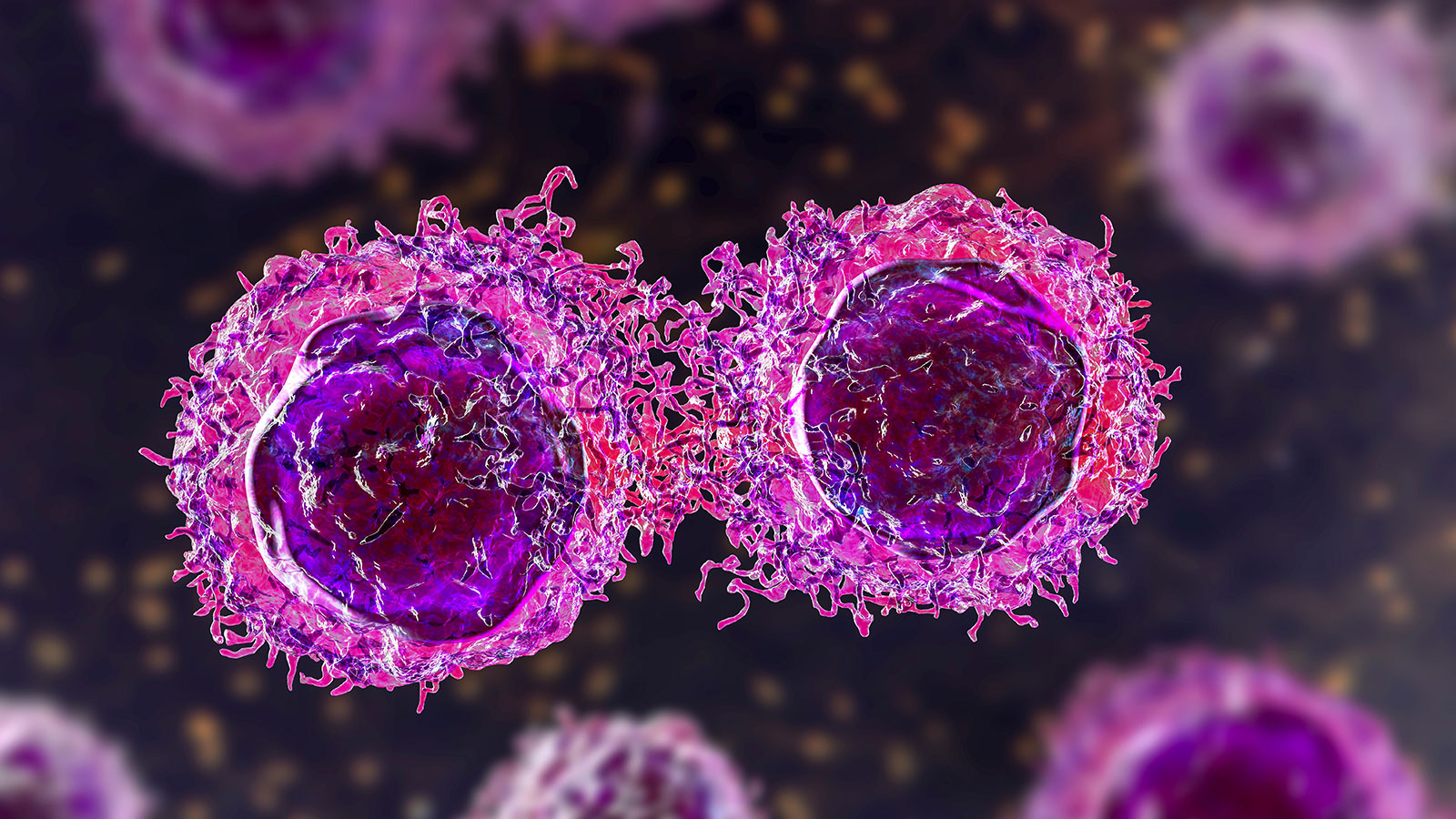 L'espoir de « l'intelligence artificielle » dans le cancer : les cellules peuvent être détectées à l'échelle nanométrique