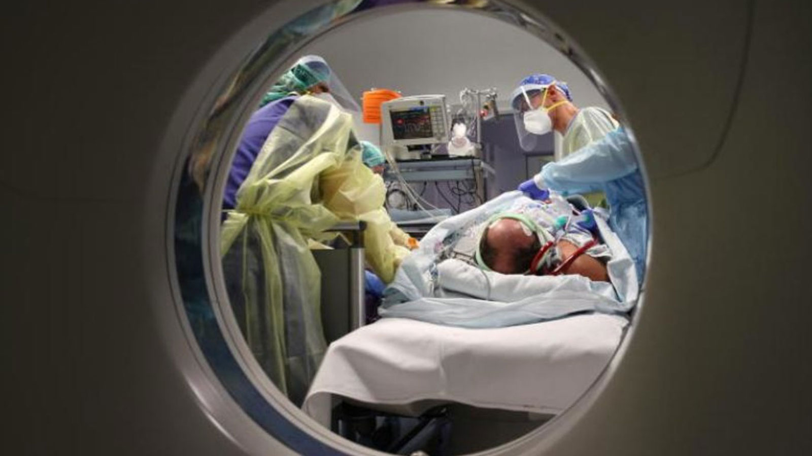 Il tue sournoisement ! La septicémie met la vie en danger