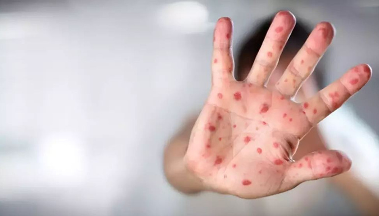 Faut-il avoir peur ? Cela se verra éventuellement en nous - Photo : 2