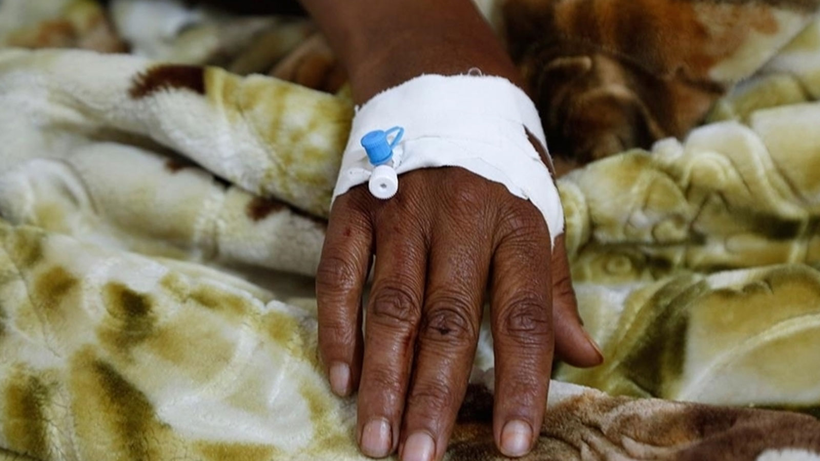 Alerte d'épidémie de choléra dans plusieurs pays de l'OMS