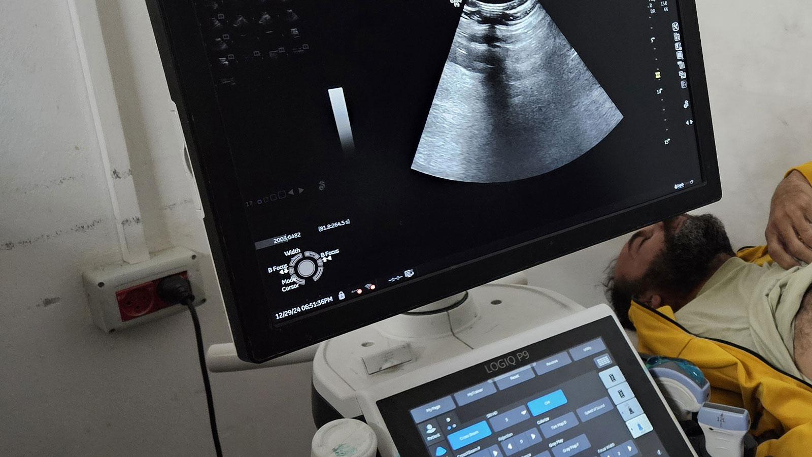 Ministère palestinien de la Santé : Nous connaissons une pénurie de médicaments et de fournitures médicales