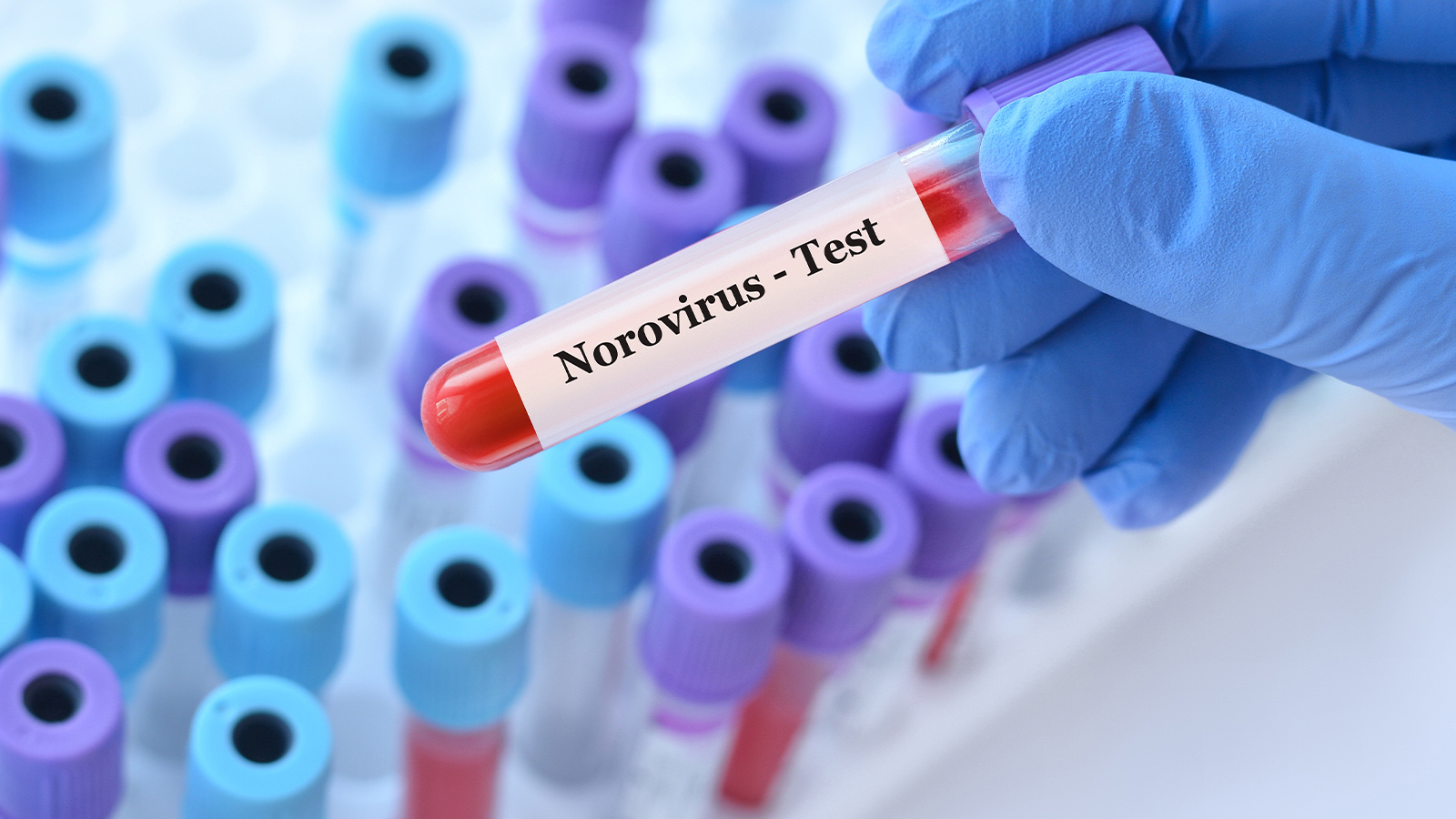 Le virus se propage rapidement, maintenant le danger du norovirus