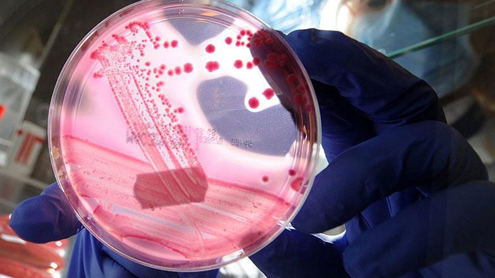 Découverte naturelle qui peut arrêter le cancer des scientifiques