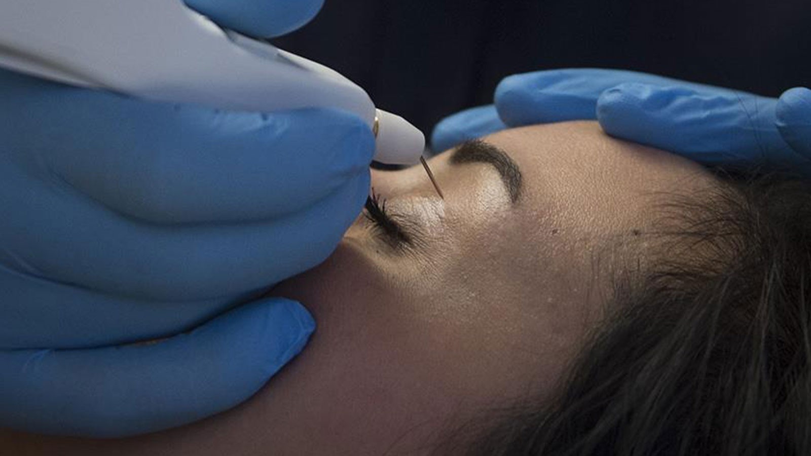 Les paupières basses ne devraient pas être un cauchemar