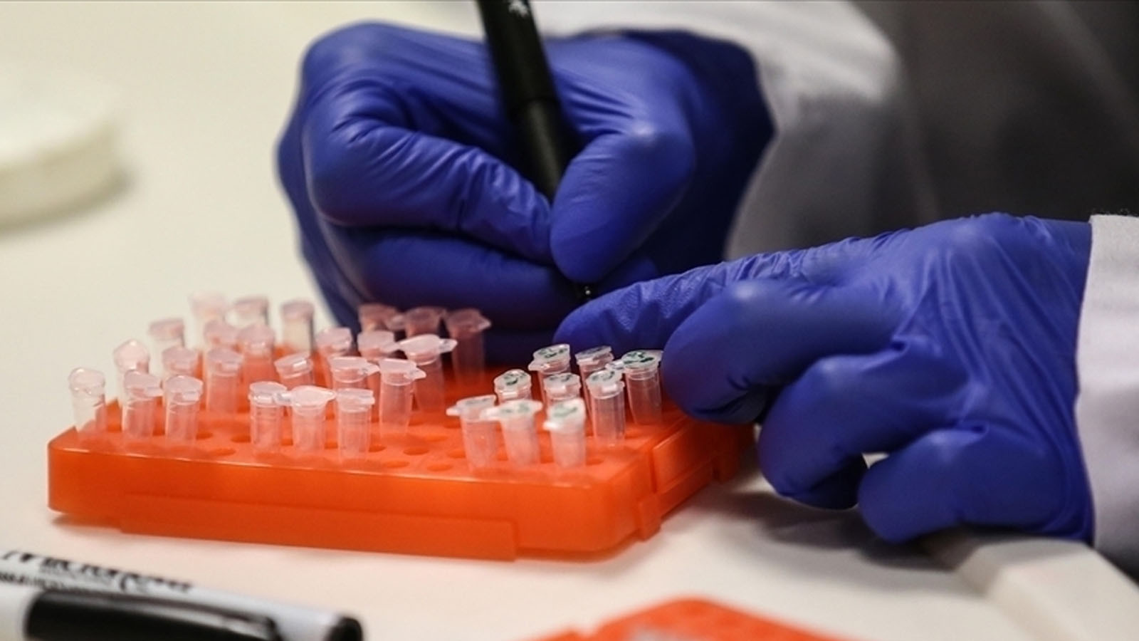 Alarme du virus de MLOWER dans le pays! Le nombre de cas augmente de jour en jour