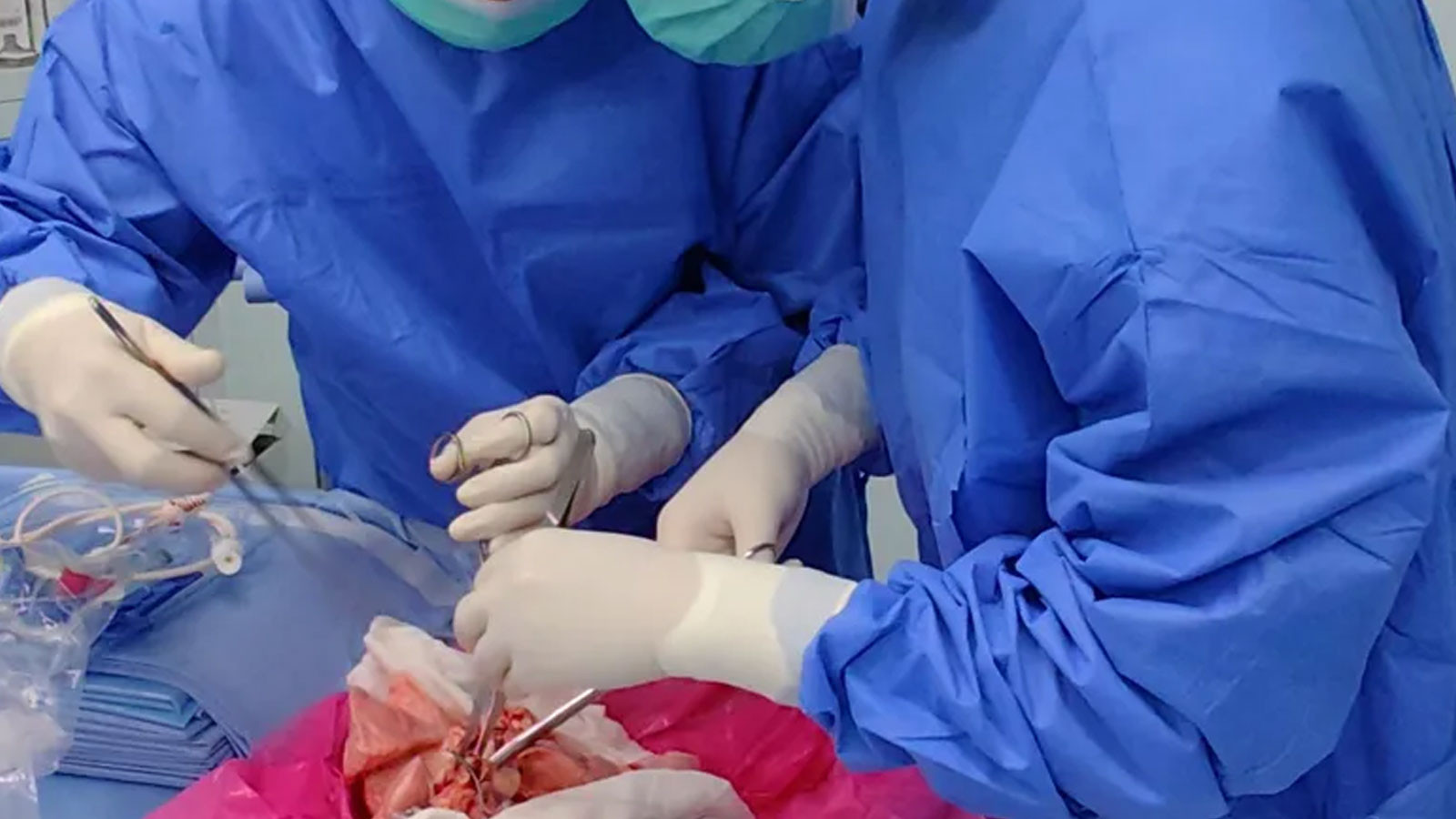 Cela a eu lieu pour la première fois au monde! La mort cérébrale a été transplantée à la personne qui a eu lieu