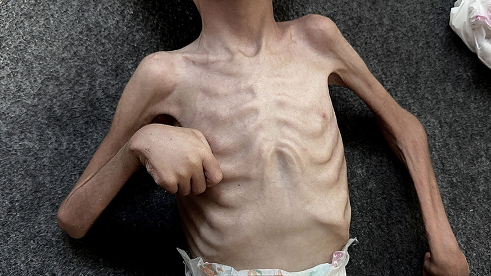 Gaza est en train de mourir de faim! Perte de vie 94 enfants sont passés à 188