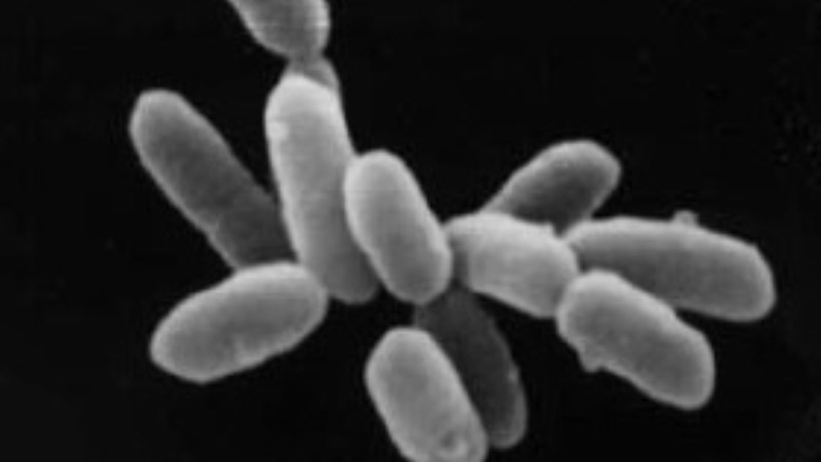 Nouvel espoir contre les bactéries résistantes aux antibiotiques, qui sont troublées par l'humanité: les arqueasinas