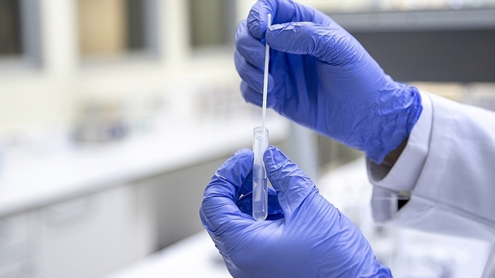 Cela passe de l’animal à l’humain… Le nombre de cas augmente chaque jour ; les pertes en vies humaines ont atteint 172