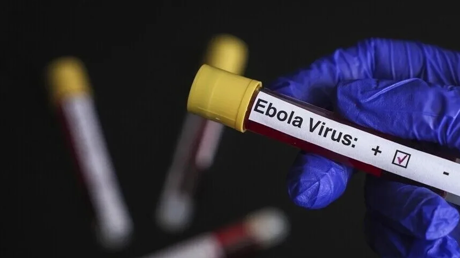Déclaration d'Ebola de l'OMS : 5 mille 794 cas et 2 mille 786 décès ont été signalés dans le pays