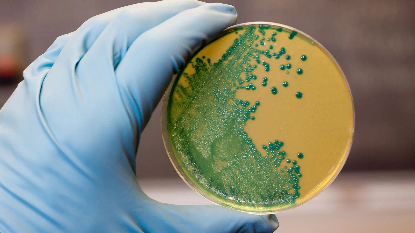 Le risque de listeria se propage, inquiétude mondiale concernant le fromage